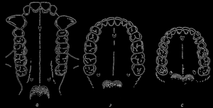Рис. 75. Зубы верхней челюсти гориллы, австралопитека и современного человека (слева направо). Зубы верхней челюсти гориллы отличаются отдельным направлением специализации (линия зубов в виде буквы U, сильное развитие клыков, их расположение за линией зубов); по Ле-Грос-Кларку. (Le Gros Clark)