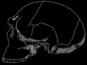 Рис. 80. Частично реконструированный череп из Steinheim. Хотя этот череп относится к неандертальским формам, он отличается среди них примитивным строением; по Ле-Грос Кларку