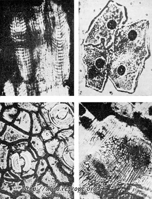 Рис. 31. Находки из Geiseital, сохранившиеся в слоях бурого угля. Прекрасное состояние этих находок позволило исследовать их микроскопическое строение. 1 - волокна поперечнополосатых мышц, 2 - эпителиальные клетки кожи лягушки, 3 - щели в кожице листа, 4 - бактерии в трахее хруща; по Z. Bulow