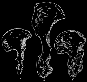 Рис. 74. Сравнение формы костей таза. А - австралопитек, В - шимпанзе, С - современный человек. Бедренная кость австралопитека и современного человека обладает некоторым сходством, бедренная же кость шимпанзе отличается продолговатой формой; по П. Грассэ